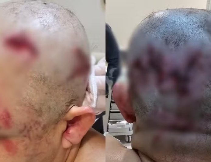 Acusado de tentar matar ex-namorada a marretadas vai a julgamento