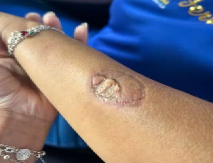 Mãe agride funcionárias e morde vice-diretora dentro de colégio estadual