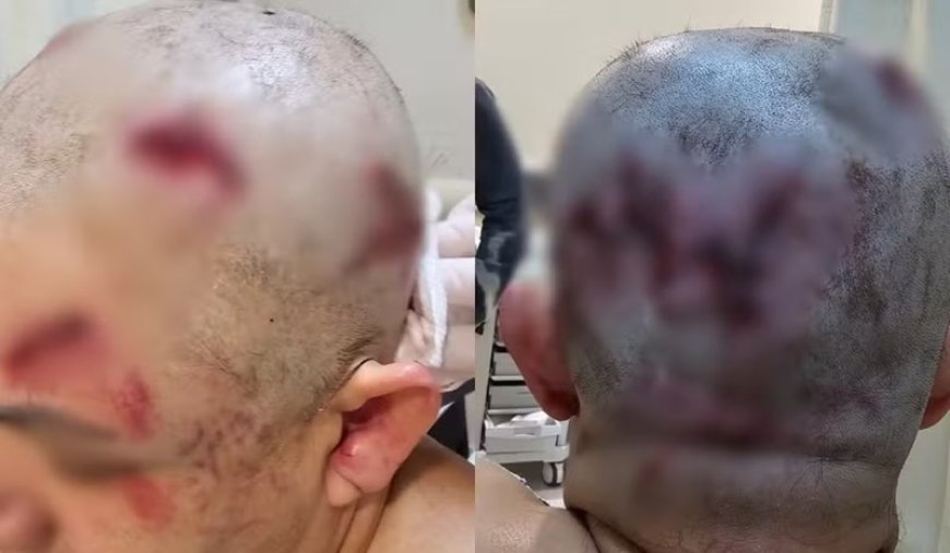 Acusado de tentar matar ex-namorada a marretadas vai a julgamento