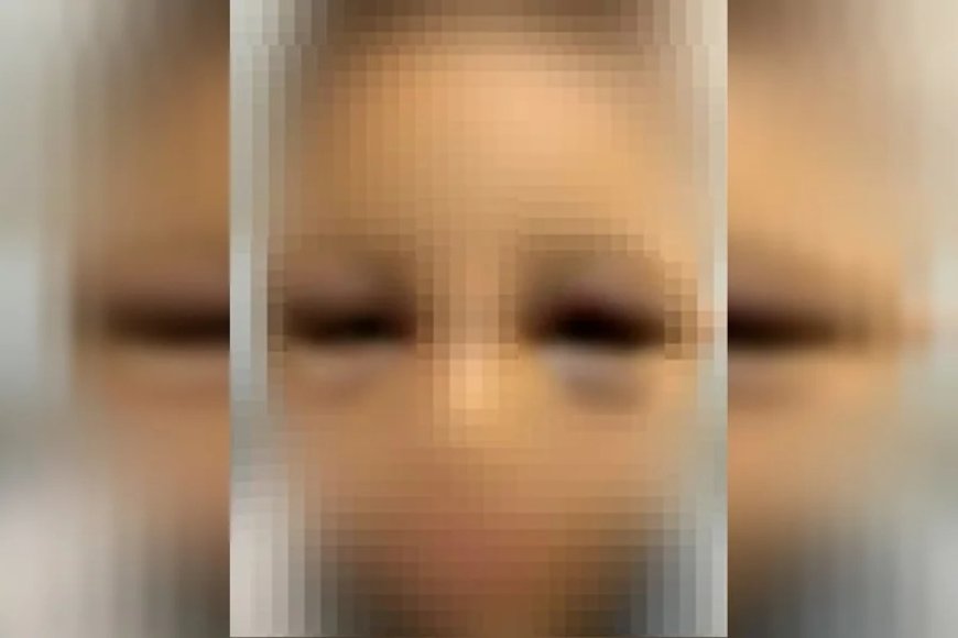 Pai preso por espancar filho de 6 anos disse que queria “corrigi-lo”