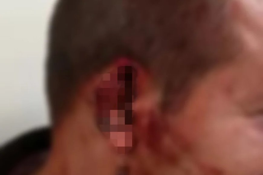 Mulher acusada de arrancar orelha de homem e jogar no lixo é presa