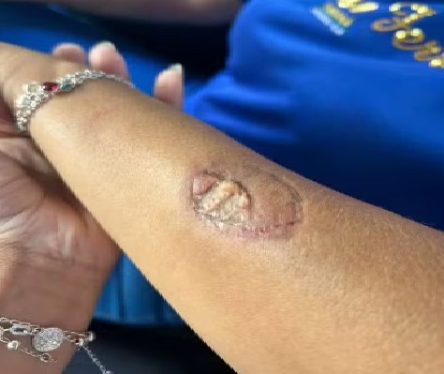 Mãe agride funcionárias e morde vice-diretora dentro de colégio estadual