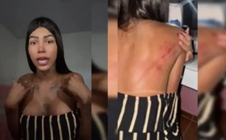 Garota de programa é agredida por esposa de cliente dentro de motel