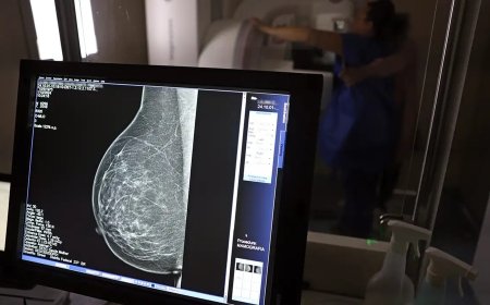 Nova lei reforça direito a três folgas por ano para exames preventivos