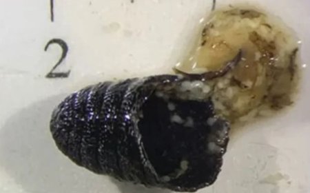 Terror Médico: Mulher espirra "vermes" e médicos descobrem ninho de larvas em seu rosto