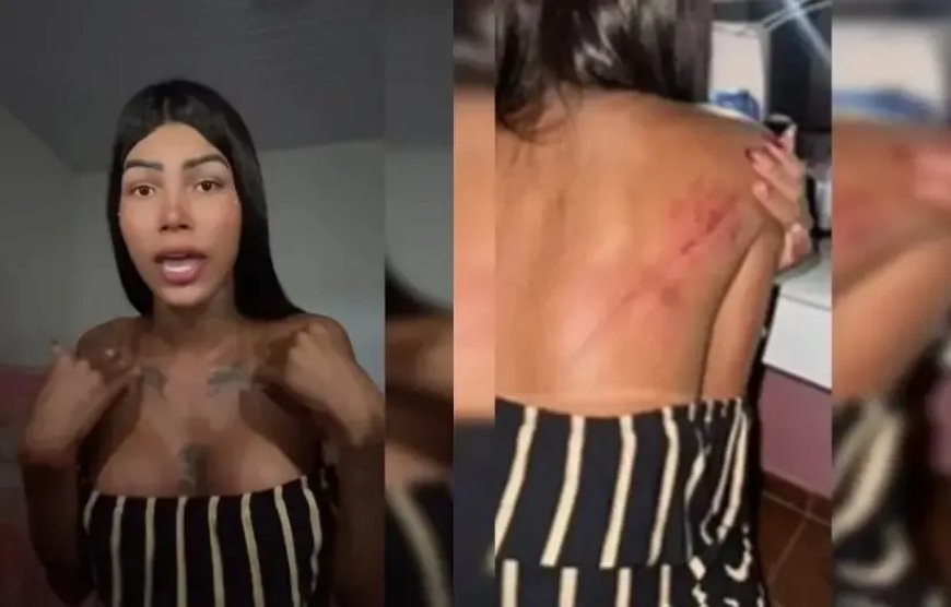 Garota de programa é agredida por esposa de cliente dentro de motel