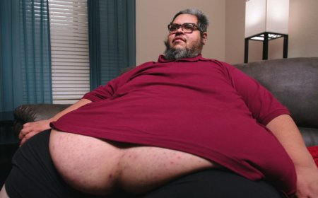 "Quilos Mortais": veja como está Dominic, expulso do reality com 300 kg
