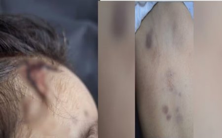 Menina de 2 anos morta com sinais de espancamento teria sido arrastada pela casa, diz delegado