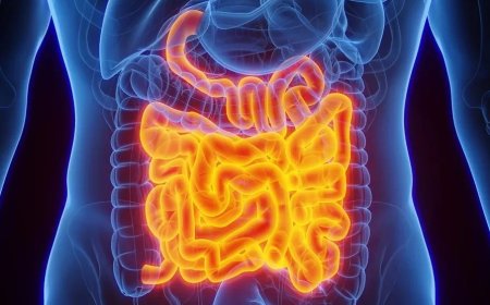 Câncer de intestino: saiba quais são os principais sintomas da doença