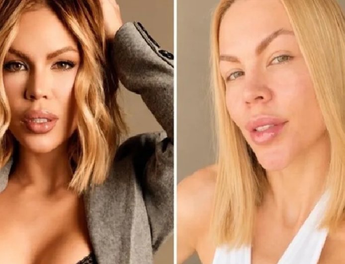 "Gastei mais de R$ 100 mil tentando desfazer meu rosto": influenciadora revela reversão estética