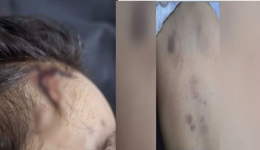 Menina de 2 anos morta com sinais de espancamento teria sido arrastada pela casa, diz delegado