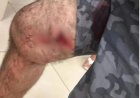 Policial militar é preso após balear homem durante discussão