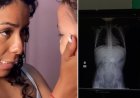 Mãe se choca após filha revelar o que engoliu, e raio-X confirma