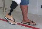 Homem é preso após amputar o pé para receber seguro de R$ 1,5 milhão