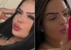 Jovem de 28 anos morre dias após extrair dente do siso e caso é investigado