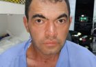 Acusado de matar enfermeira a marretadas foge de presídio