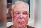 Idoso de 69 anos é atacado por grupo na porta de casa