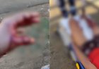 Suspeito fere PM com facada durante abordagem e cena termina em tiros; veja
