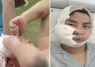 Turista entra em tanque para nadar e acaba atacado por tubarão
