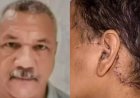 Homem que esfaqueou e decepou orelha da ex-companheira é condenado a 33 anos de prisão