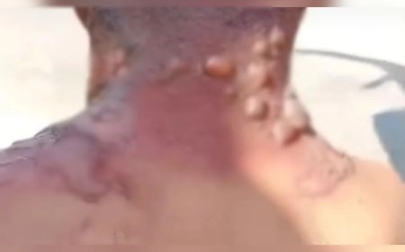 IMAGENS FORTES!! Homem acusa namorada de mantê-lo em cárcere e queimá-lo com água fervente