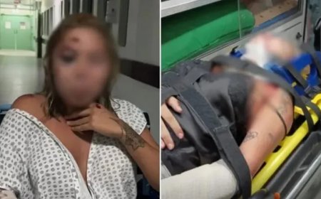 Passageira diz ter sido atropelada por motorista de app após discussão