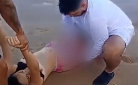 IMAGENS FORTES! Jovem perde a perna após ataque de tubarão em Boa Viagem, um dia após incidente com criança