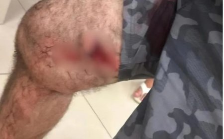 Policial militar é preso após balear homem durante discussão