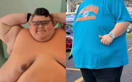 “Progredindo”, afirma Gordão da XJ ao mostrar corpo após perder 130 kg.