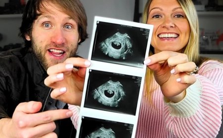 Youtubers relatam ameaças após abortarem bebê que teria Down