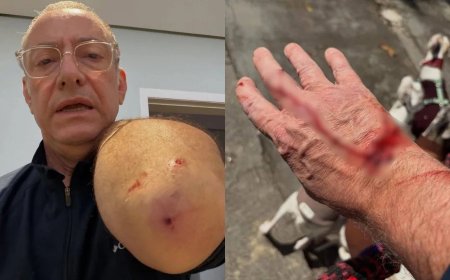 Apresentador da Globo é atacado por pitbull e mostra ferimentos