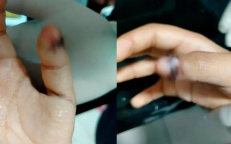 Menino autista tem dedo esmagado na porta da escola e família denuncia