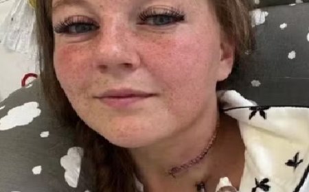 Mãe descobre câncer terminal na língua após médicos insistirem que sintoma era efeito da gravidez