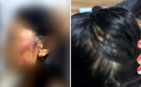 Mulher pula de moto em movimento para se salvar após ser estupr@da e espancada, diz polícia