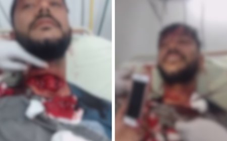 Motociclista sobrevive a corte profundo de cerol e choca a internet ao sorrir durante a cirurgia