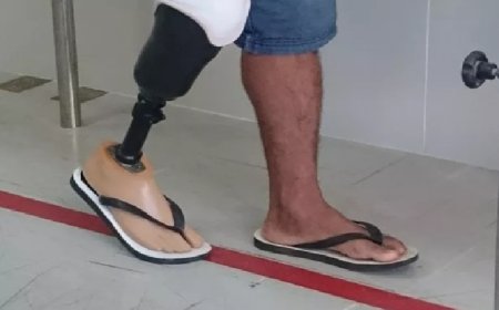 Homem é preso após amputar o pé para receber seguro de R$ 1,5 milhão
