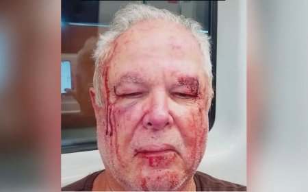 Idoso de 69 anos é atacado por grupo na porta de casa