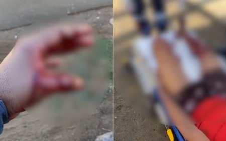 Suspeito fere PM com facada durante abordagem e cena termina em tiros; veja