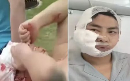 Turista entra em tanque para nadar e acaba atacado por tubarão