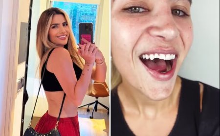 Filha de Leonardo sofre queda em noite romântica e quebra o dente: “Foi um desastre”