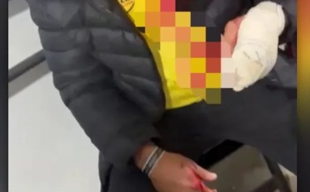 Vereador de MG é acusado de agredir homem com garrafadas em boate