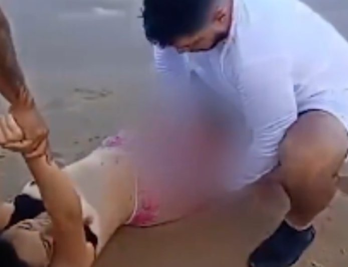 IMAGENS FORTES! Jovem perde a perna após ataque de tubarão em Boa Viagem, um dia após incidente com criança