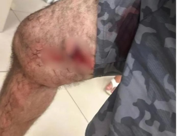 Policial militar é preso após balear homem durante discussão