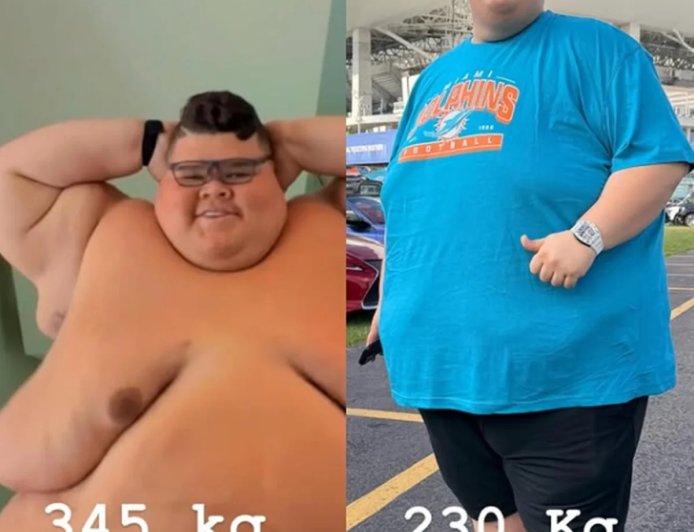 “Progredindo”, afirma Gordão da XJ ao mostrar corpo após perder 130 kg.