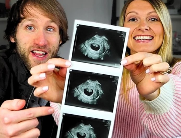 Youtubers relatam ameaças após abortarem bebê que teria Down