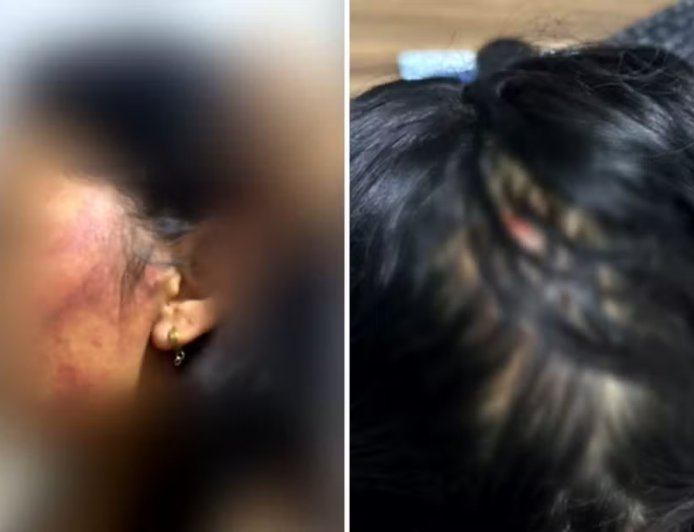 Mulher pula de moto em movimento para se salvar após ser estupr@da e espancada, diz polícia