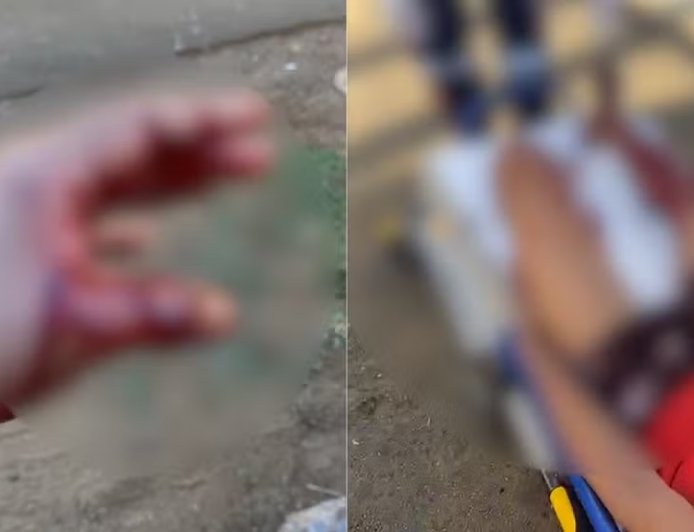 Suspeito fere PM com facada durante abordagem e cena termina em tiros; veja