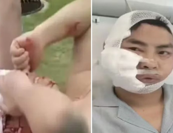 Turista entra em tanque para nadar e acaba atacado por tubarão