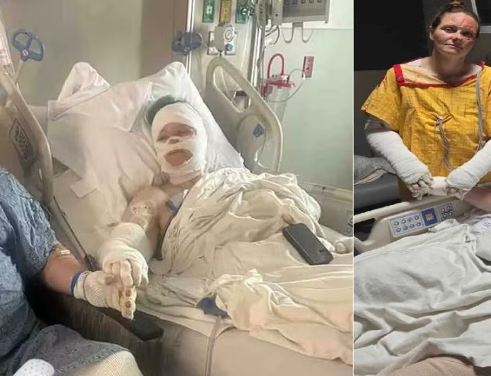 É um milagre": casal sobrevive a explosão e história comove milhares de pessoas