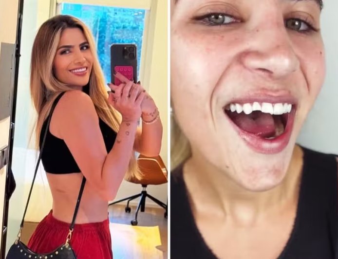 Filha de Leonardo sofre queda em noite romântica e quebra o dente: “Foi um desastre”